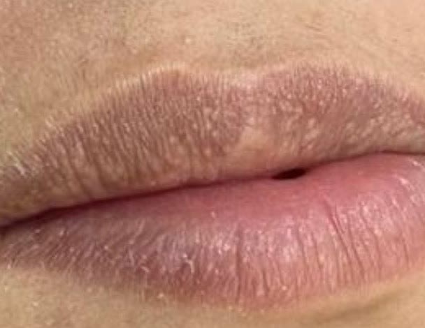 Antes da harmonização labial