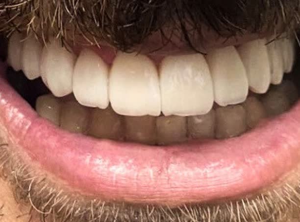 Depois do tratamento estético do sorriso